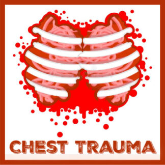 Chest Trauma: Assessment & Interventions