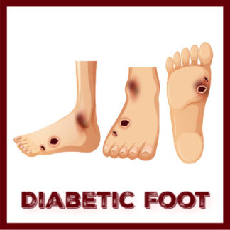 March 18: Safe Steps Forward: Diabetic Foot Ulcers